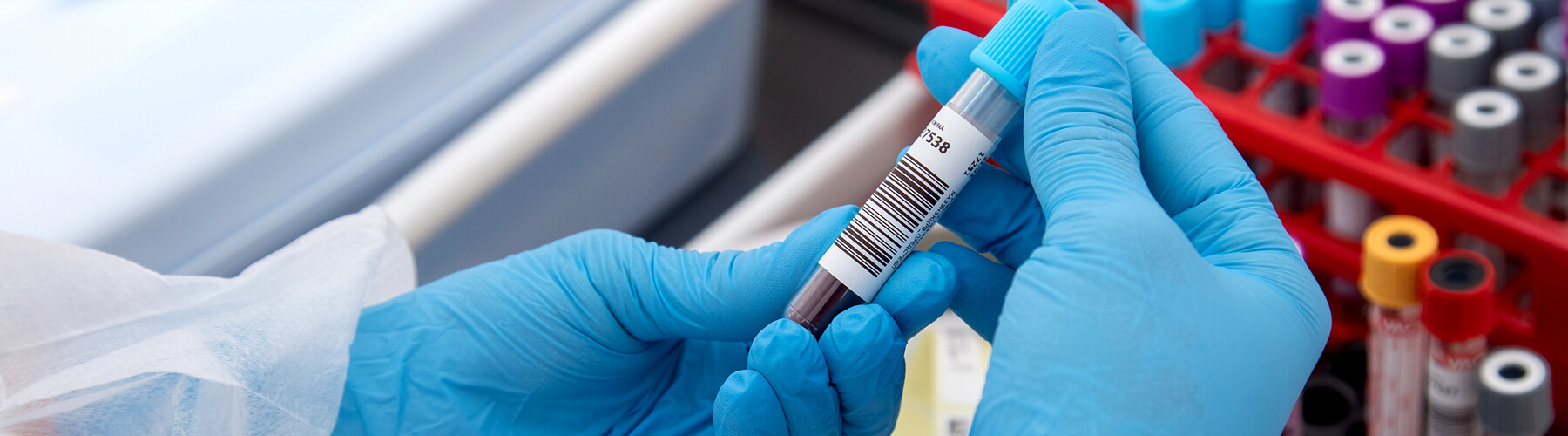 Blood Testing boynton beach iv therapy